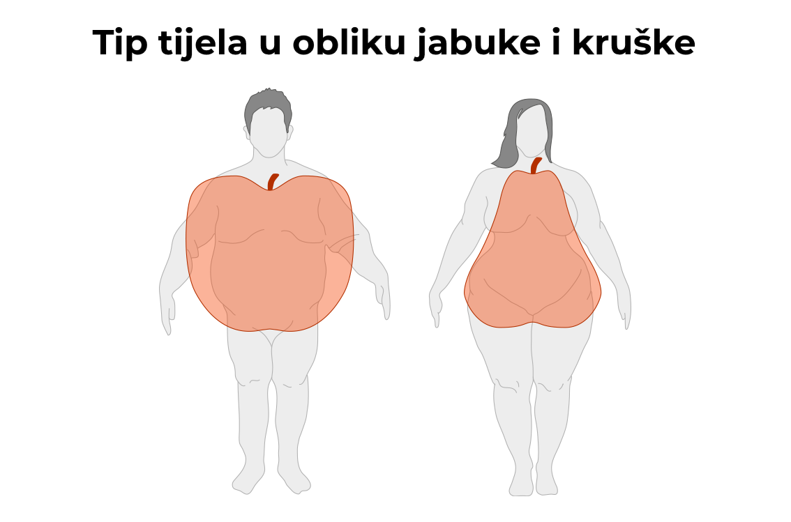 Androidna vs. ginoidna pretilost